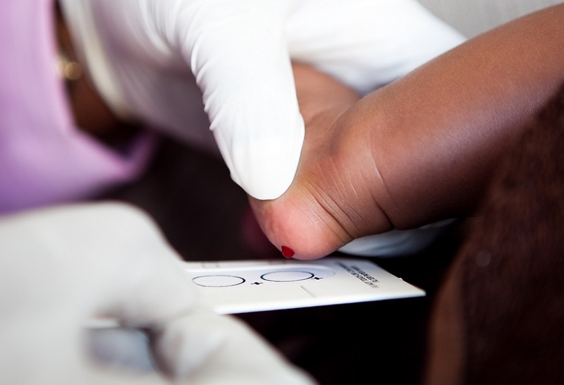 hiv aids treatment south africa 